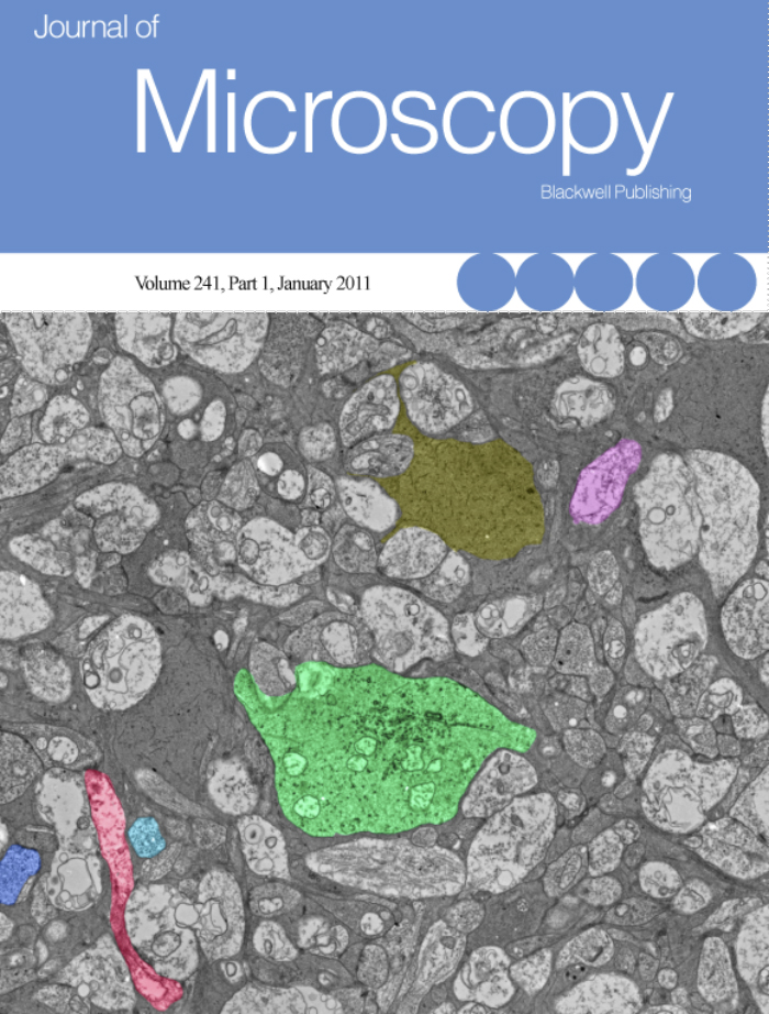 J Microscopy 2010