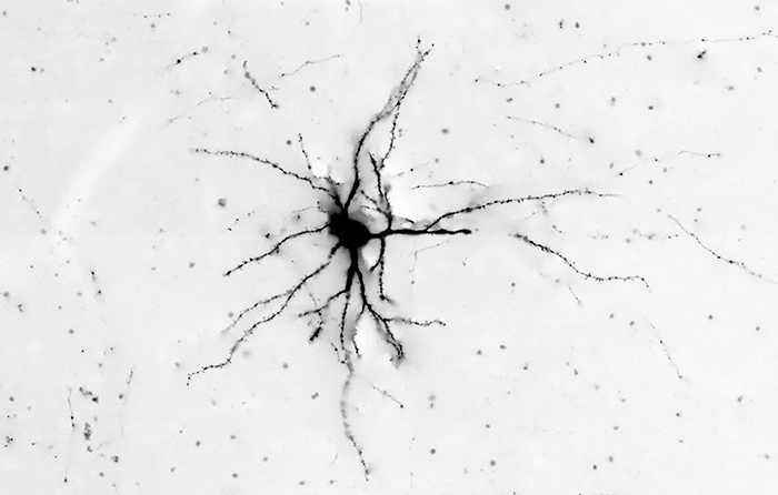 More neuron