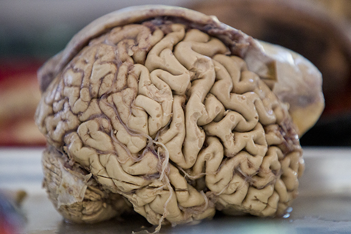 Human Brain_
