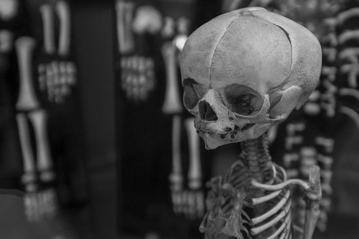 Infant skeleton