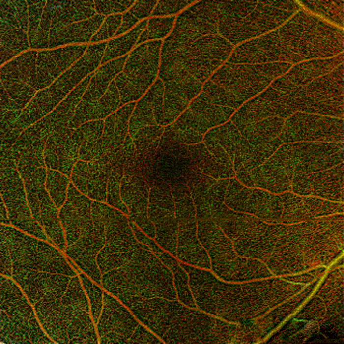 BWJones retinal vasculature1