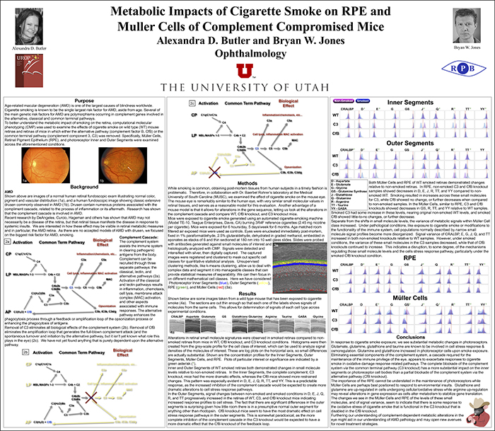 Metabolic Impacts of Cigarette Smoke on RPE